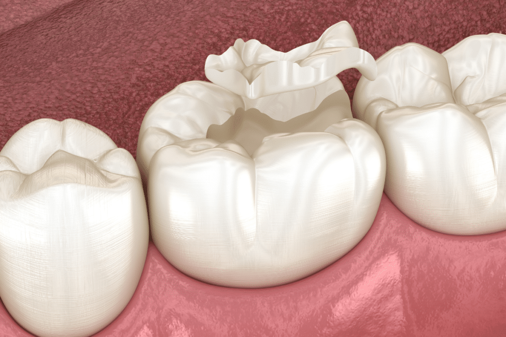 healthy children smile after dental sealants protection
